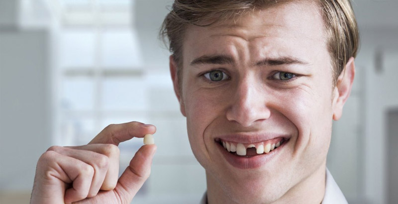 Nên phục hình khi bị mất răng để đảm bảo sức khỏe răng miệng