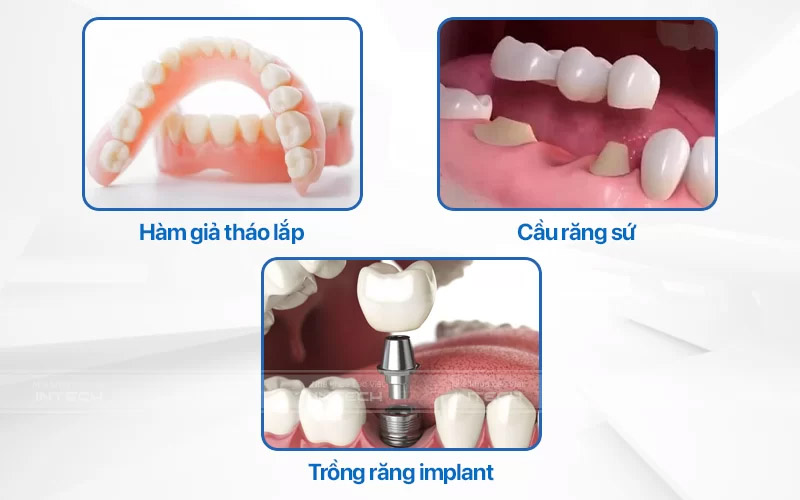 Có 3 phương pháp phục hình răng phổ biến hiện nay