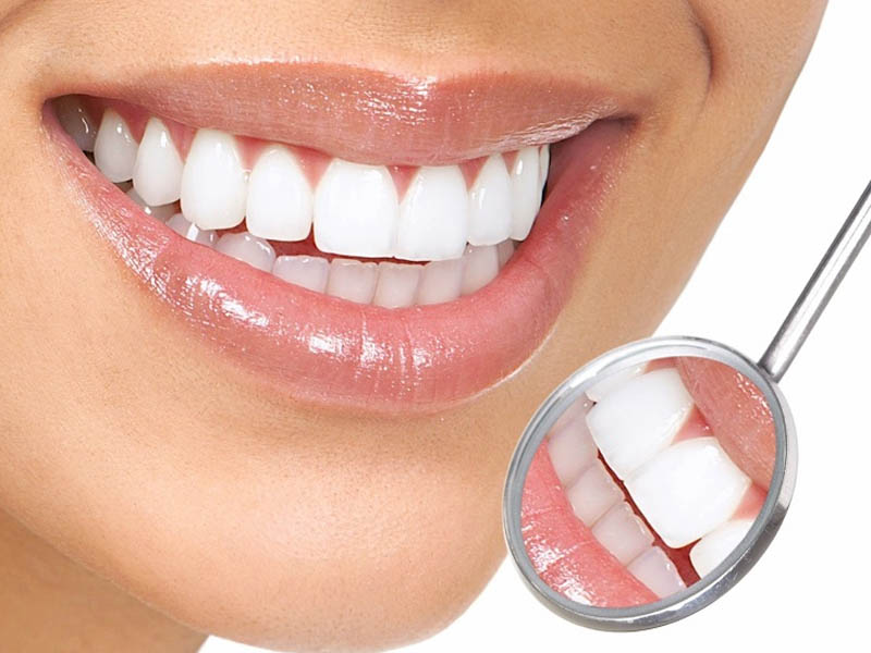 Chi phí trồng răng sứ không có chân răng phụ thuộc vào nhiều yếu tố