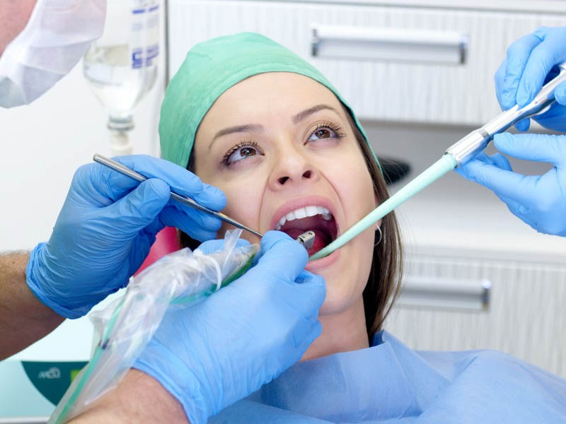 Trồng răng cố định cần thực hiện một số dịch vụ liên quan
