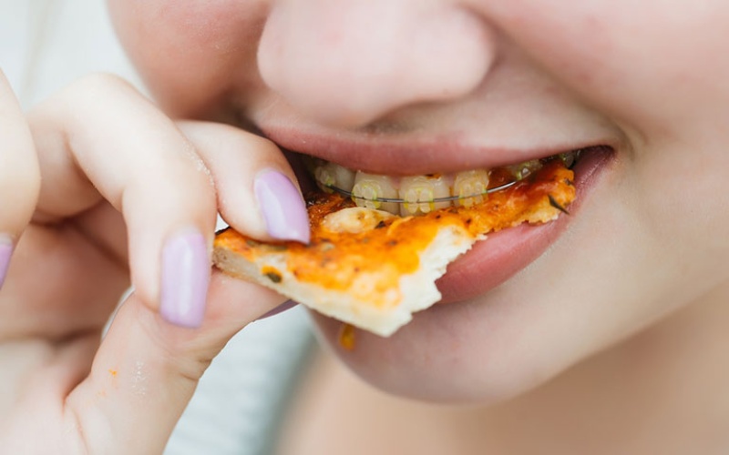 Niềng răng không nên ăn thực phẩm có tính dai hoặc dẻo, dễ bám dính vào kẽ răng