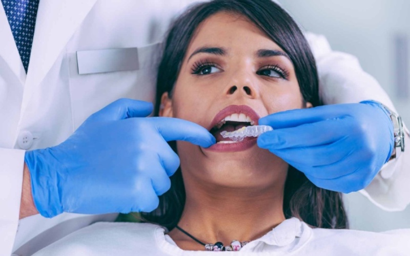 Chọn cơ sở niềng răng nhựa uy tín để đảm bảo hiệu quả tối đa