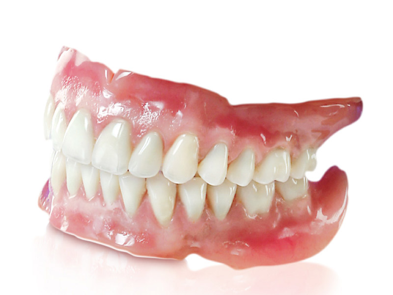 Trồng răng hàm với hàm giả tháo lắp có chi phí thấp nhất