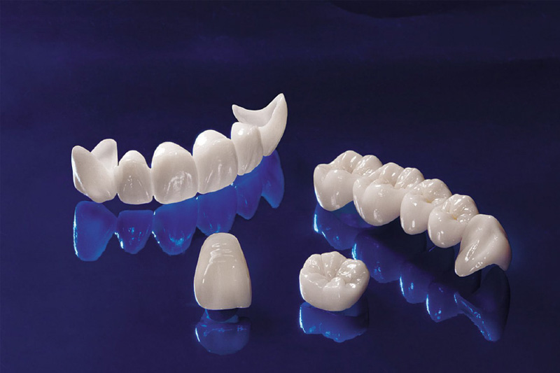 Răng sứ toàn sứ có tính thẩm mỹ cao, bền bỉ nên chi phí cũng cao hơn các dòng răng khác