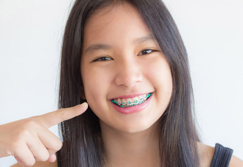 Mỗi giai đoạn chỉnh nha khác nhau, răng sẽ có sự dịch chuyển không giống nhau