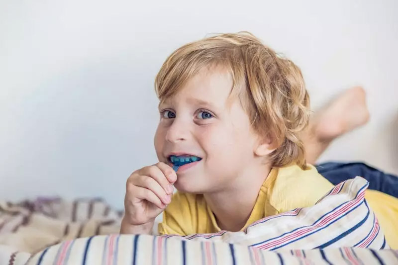 Niềng răng Silicon hàm K dùng cho trẻ từ 5 - 10 tuổi
