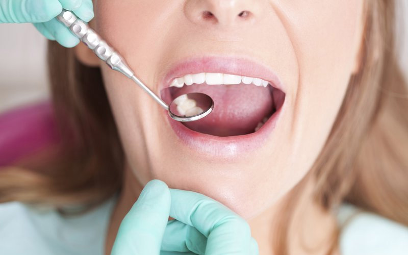 Bác sĩ điều trị dứt điểm bệnh nha khoa trước khi niềng răng