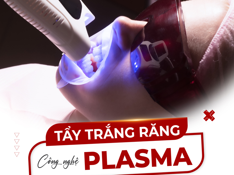 Nha khoa Đại Nam ứng dụng công nghệ tẩy trắng răng Plasma