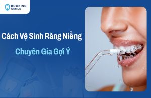 Hướng Dẫn Cách Vệ Sinh Răng Niềng Được Chuyên Gia Gợi Ý