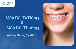 Mắc Cài Tự Đóng Và Mắc Cài Thường