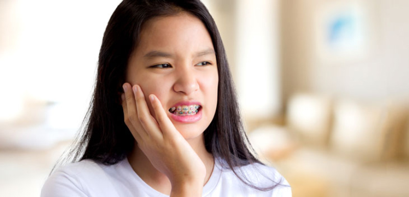 Nếu là người có cơ địa dễ dị ứng bạn không nên thực hiện niềng răng