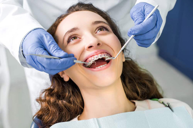 Mức giá niềng răng phụ thuộc vào tay nghề bác sĩ