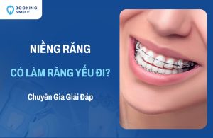 Niềng Răng Có Làm Răng Yếu Đi Không? Giải Đáp Từ Chuyên Gia