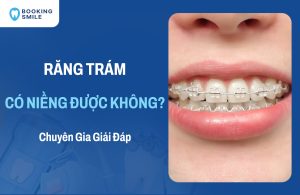 Răng Trám Có Niềng Được Không? Những Vấn Đề Cần Lưu Ý