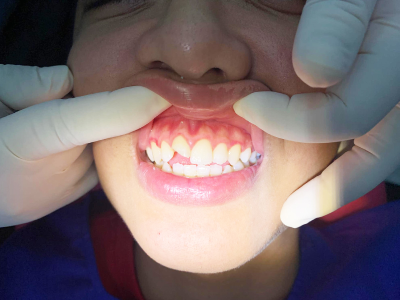 Nha khoa Sam Sum có thể xử lý tất cả vấn đề răng miệng cho khách hàng