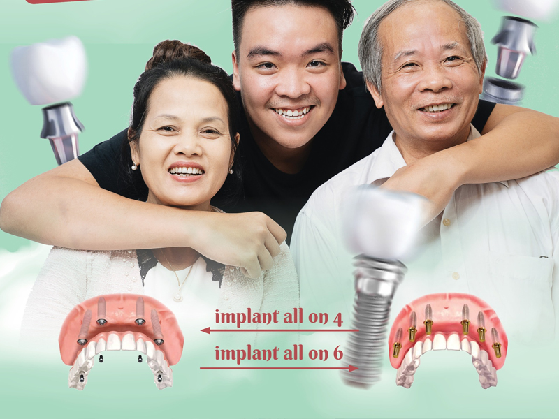 Nha khoa 360 Dental nổi bật với dịch vụ trồng răng Implant