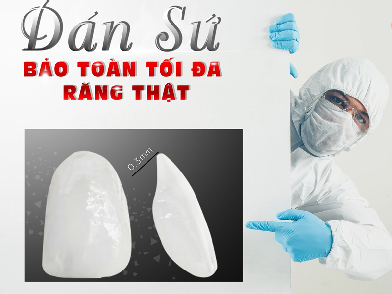 Nha khoa Đại Nam có dịch vụ dán sứ chất lượng cao