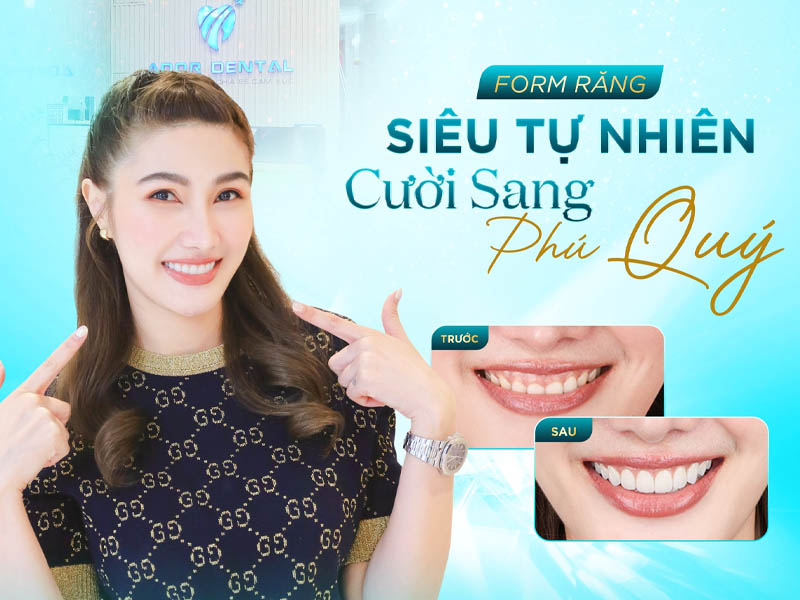 Nha khoa Ador Dental cung cấp dịch vụ làm răng sứ chất lượng cao