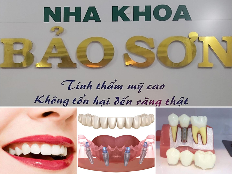 Nha khoa Bảo Sơn cung cấp đa dạng dịch vụ cho khách hàng